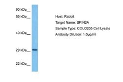 SPIN2A Rabbit anti-Human, Polyclonal, Novus Biologicals 0.1 mL | Buy Online | Novus Biologicals | Fisher Scientific